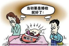 结婚婚检一定要做吗